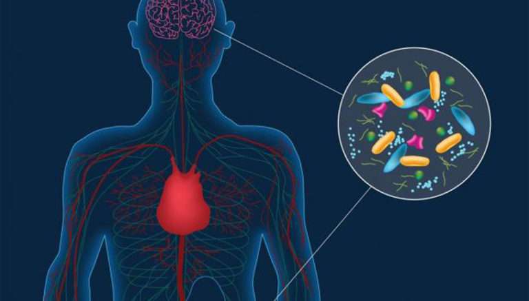 Parkinson hastalığı ile midedeki mikroplar arasında bağlantı keşfedildi.