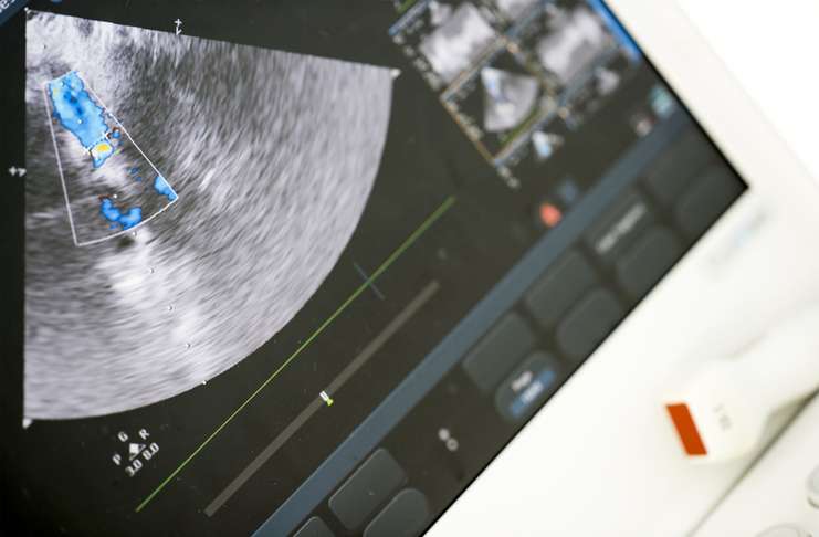 Watson Clinical Imaging Review