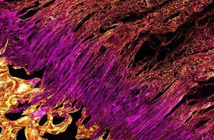 Tendon ve kemiği bağlayan ince lifler 3D yöntemi ile görüntülendi