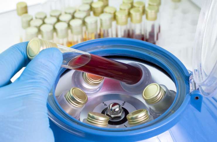 CancerLocator adlı bilgisayar programı