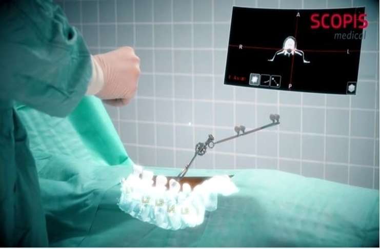 HoloLens